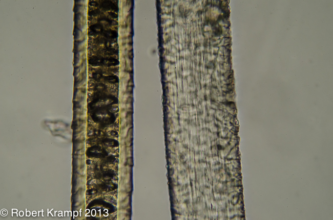 long structures under a microscope