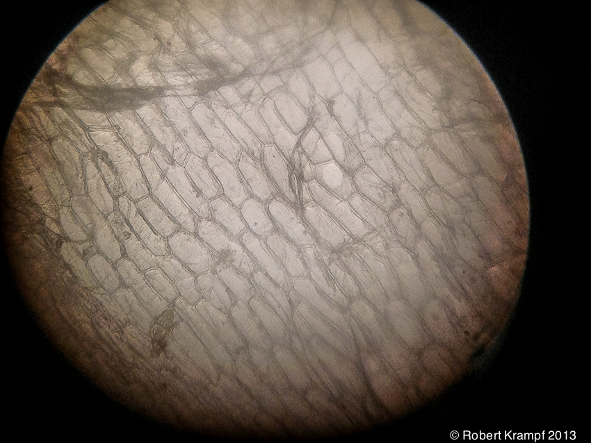 Onion cells