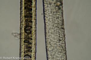 long structures under a microscope long structures under a microscope