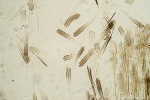 Tiny, scale-like objects Tiny, scale-like objects